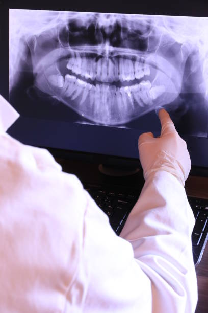 Best Emergency Dental Care for Broken or Chipped Teeth in Yountville, CA